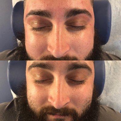 Before and after of men's eyebrows, nose & cheekbone waxing