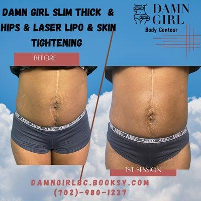 Damn Girl session and skin tightening while using Damn Girl Skin Tightening oil