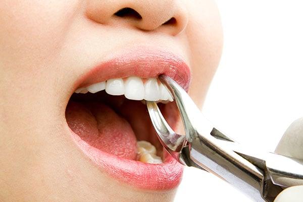 Oral Sedation Dentist