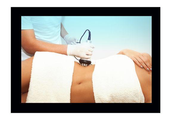 Ultrasonic cavitation, also called ultrasonic lipolysis, is a body contouring treatment that is used to remove fat deposits under your skin.