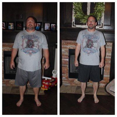 100LB down in less than 6 month after gastric sleeve