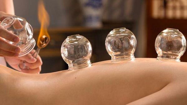 Fire Cupping. Just what you might need.