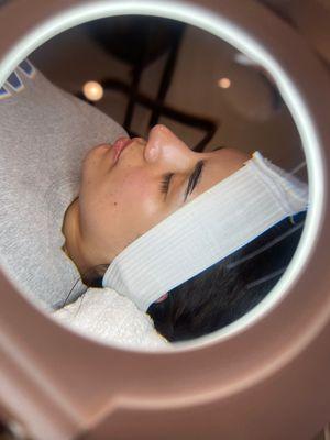 Microdermabrasion Facial