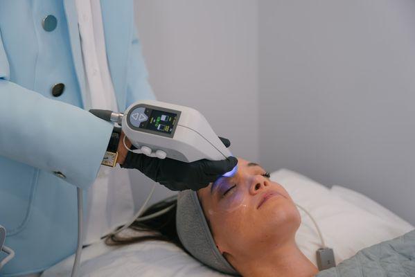 Exilis Skin Tightening Treatment for Face & Body