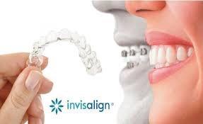 Call for free Invisalign Consultation!