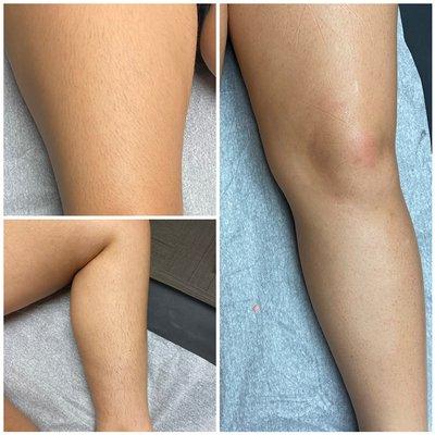 Before after full leg wax.