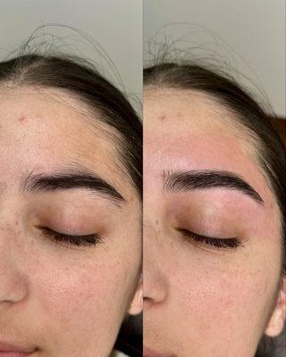 Before and after brow shaping