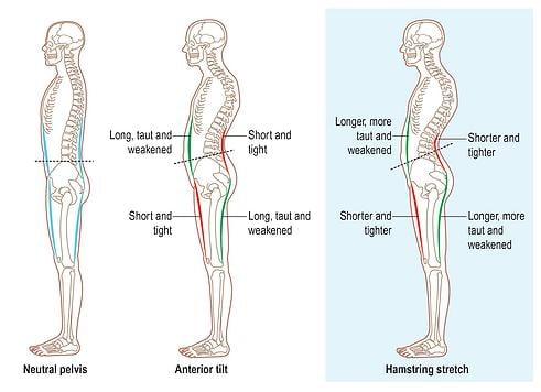 http://bit.ly/1BgKnnk The HOUSE X360 Assessment will expose which muscles are creating your imbalance and pain