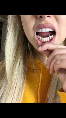 Bottom Rose gold fangs