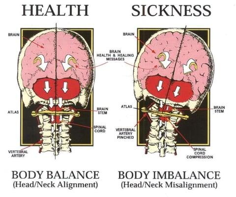 Your head weights about the same as a bowling ball, around 10 lbs.  But when it's out of place, you have to shift your ENTIRE...