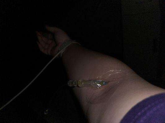 Iv therapy