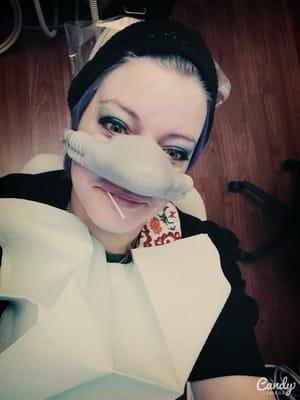 Laughing gas is optional in case you would rather not. I opted in of course!