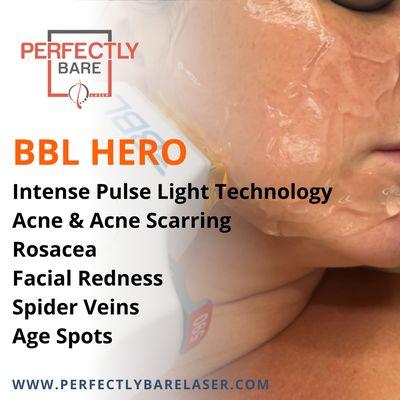 Suffering from skin issues such as acne, scarring, age spots.  Perfectly Bare has added the top of the line Sciton BBL Hero at our MedSpa