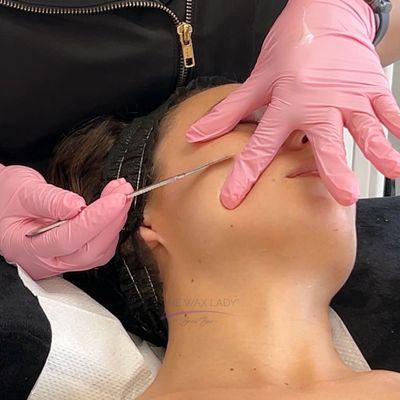 Dermaplaning for soft, hydrated skin