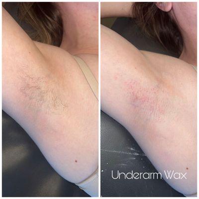 Underarm Wax