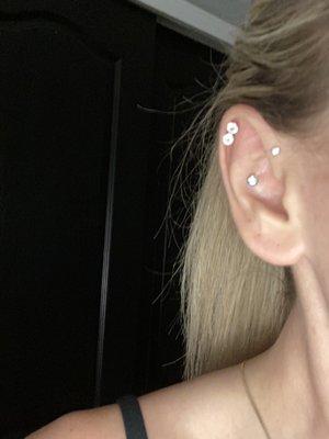 Forward Helix and Conch