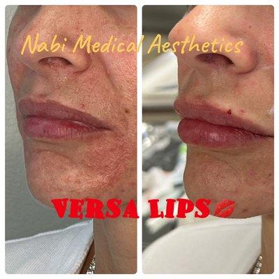 Nabi Medical Aesthetics