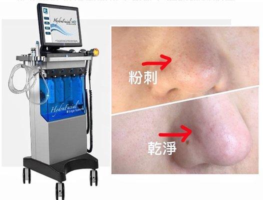 定期来做水飞梭HydraFacial，还能顺便清一下痘痘黑头粉刺，使皮肤干净透亮，美美哒