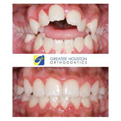 Greater Houston Orthodontics