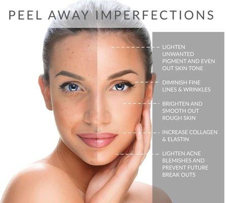 Chemical peel event November 9,10 and 11 must RSVP!!