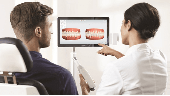 Intraoral scanner