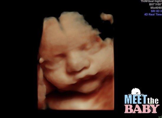 HD ultrasound! From Meet the Baby!!