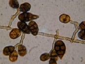 Unocladium Spores