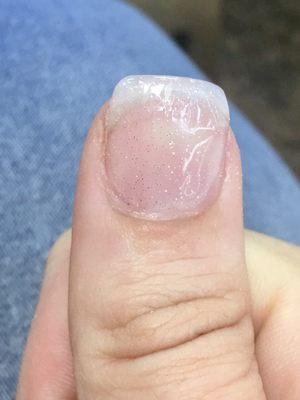 More missing gel on tip of nail