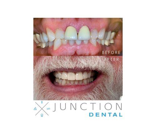 Junction Dental