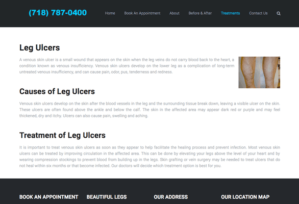 Leg Ulcers Treatment