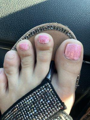 This is the day after a GEL pedicure