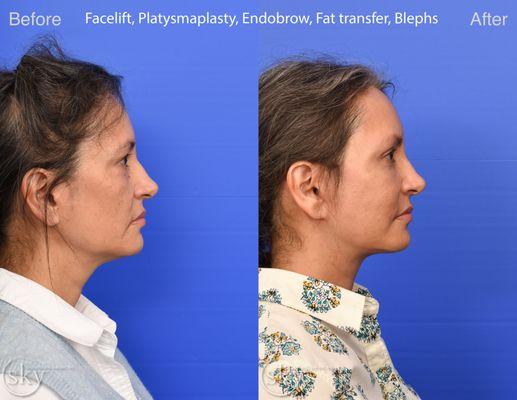 SKY Facial Plastic Surgery