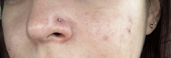 nostril piercing