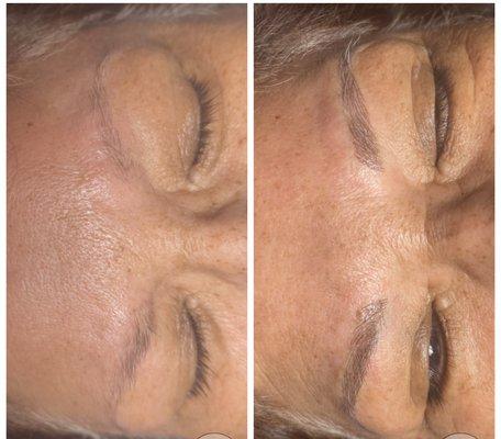 Before and after Microblading