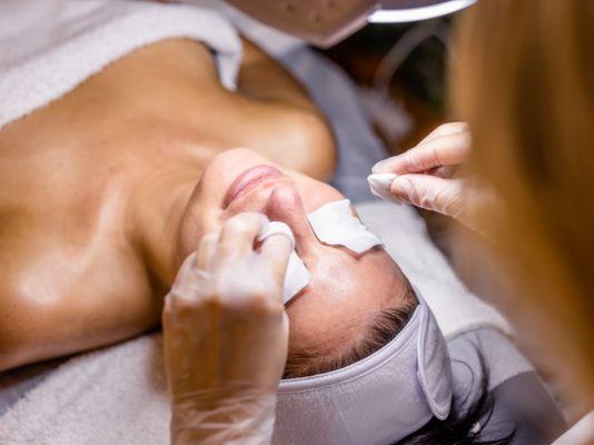 Acne Facial