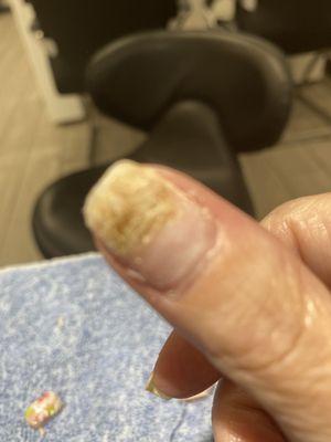 My fungus from previous nail salon