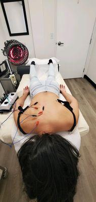 Electroacupuncture