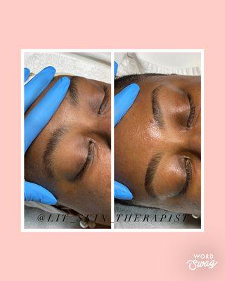 Before & After brow wax