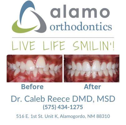 Ready to have a life changing smile?! Give us a call!! :) 

575-434-1275