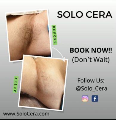 Woman's Underarm Wax!