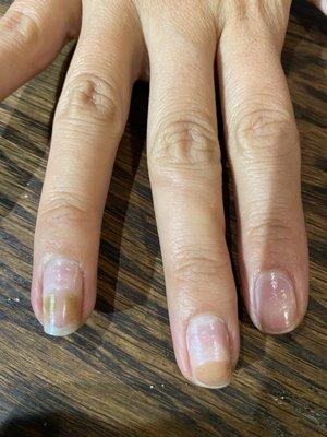 Ruined nails