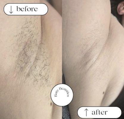 Underarm Wax by Saray