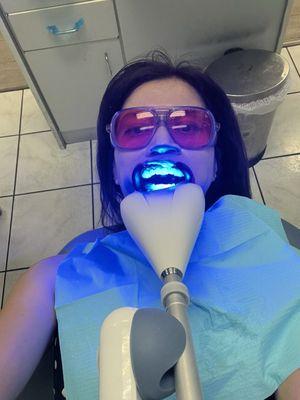 Teeth whitening