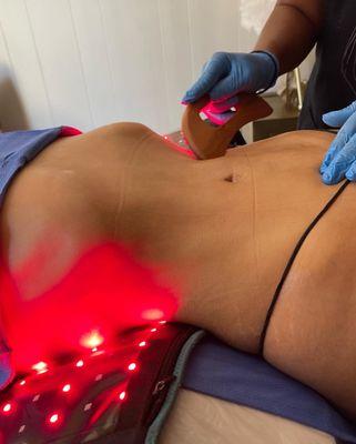 RF skin tightness! Creating lasting result with Red light treatments