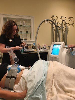 We Love Coolsculpting!