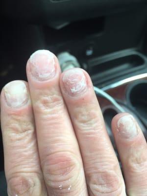 here's what hey did to my nails when removing my acrylics...what a nightmare!