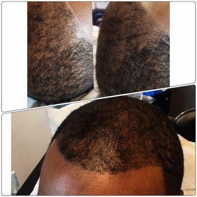 Scalp pigmentation adding fullness