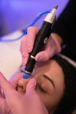 Hydrafacial is the perfect go-to facial for anyone wanting a skin boost. We also offer membership options that are affordable.