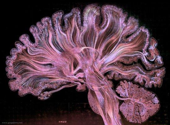 Human Brain is a thing of Beauty