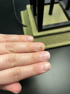 My natural nails 2 weeks after a fill in at solar.